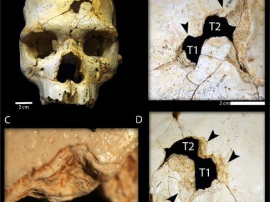 破解43万年前凶杀案？Materialise 3D建模软件大显身手