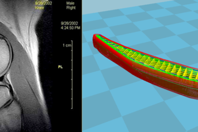 革命性新材料强度胜ABS10倍 可3D打印膝关节植入物