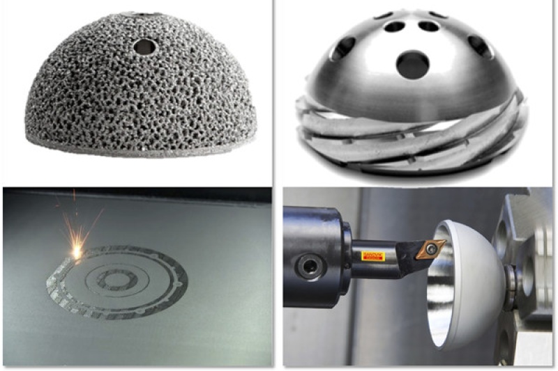 如何制作一个金属3D打印医疗植入物？（上）