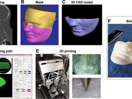 3D生物打印面罩可快速治疗面部创伤